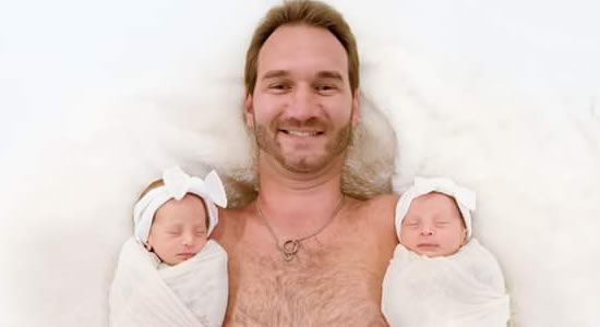 Limbless Evangelist, Nick Vujicic Share Photos Of His Twins