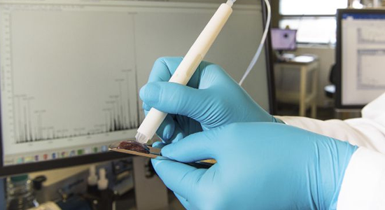 Scientists Invented A Pen That Can Screen For Cancer In Seconds 