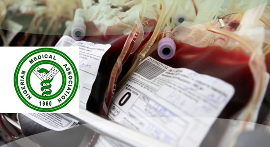 NMA Urges NASS To Pass National Blood Service Commission Bill