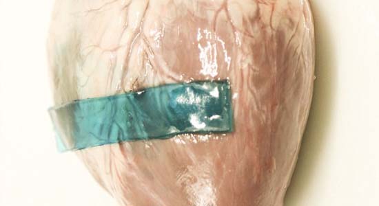 New Human Protein-Based Surgical Glue Seals Wounds in 60 Seconds, Medicine